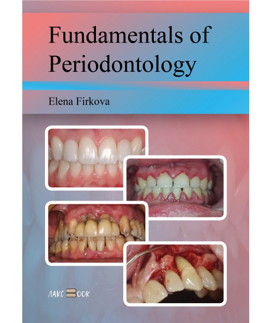 Fundamentals of Periodоntology