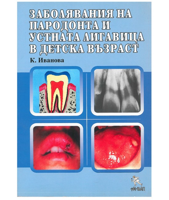 Заболявания на пародонта и устната лигавица в детска възраст 